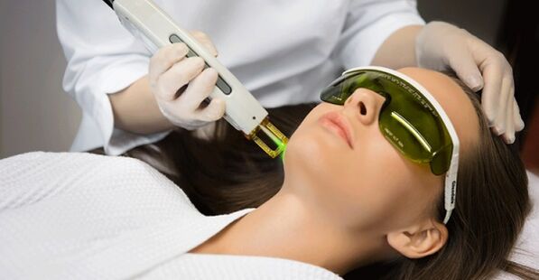 Procedura de întinerire a pielii non-ablativă cu laser