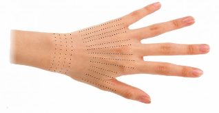 Locurile de injectare pentru mâini în timpul biorevitalizării